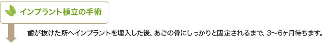 インプラント植立の手術｜歯が抜けた所へインプラントを埋入した後、あごの骨にしっかりと固定されるまで、3～6ヶ月待ちます。