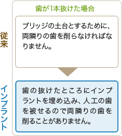 【歯が1本抜けた場合】
従来の治療法｜ブリッジの土台とするために、両隣りの歯を削らなければなりません。
インプラント治療法｜歯の抜けたところにインプラントを埋め込み、人工の歯を被せるので両隣りの歯を削ることがありません。