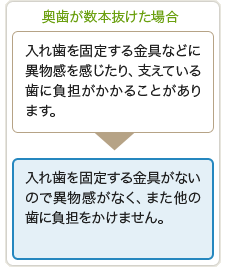 【奥歯が数本抜けた場合】
従来の治療法｜入れ歯を固定する金具などに異物感を感じたり、支えている歯に負担がかかることがあります。
インプラント治療法｜入れ歯を固定する金具がないので異物感がなく、また他の歯に負担をかけません。